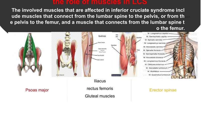 ایران فایلز پاورپوینت ناهنجاری سندروم متقاطع تحتانی به زبان انگلیسی